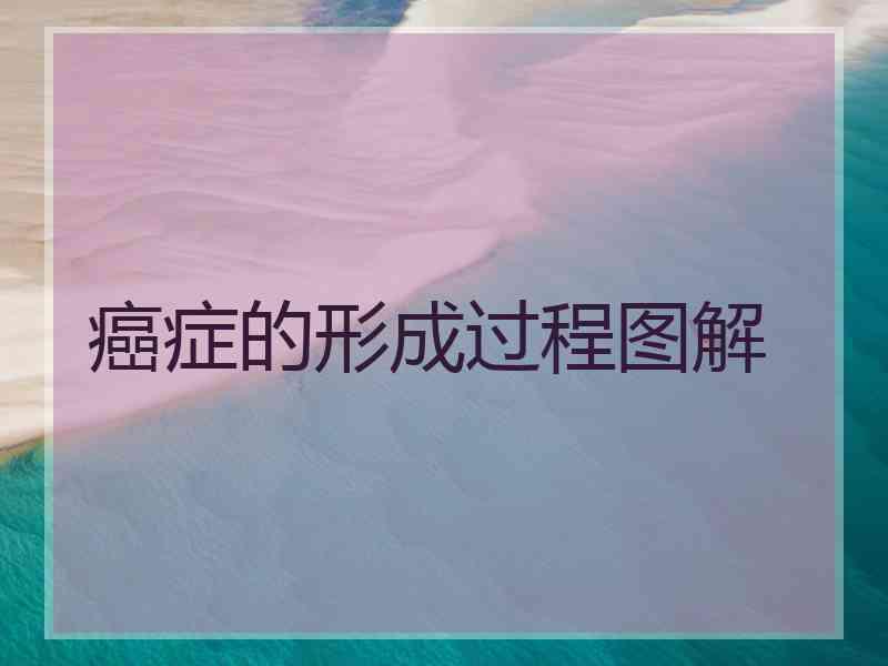 癌症的形成过程图解