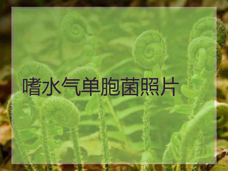 嗜水气单胞菌照片