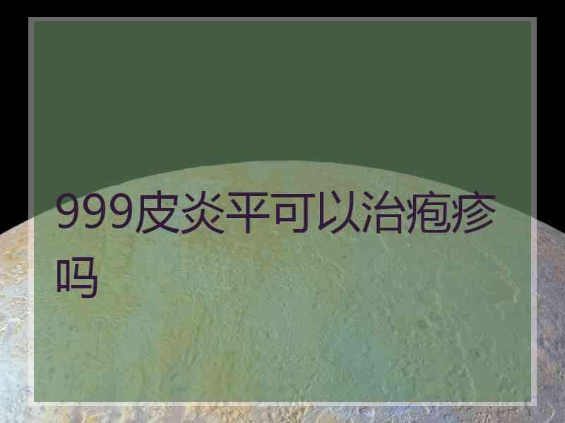 999皮炎平可以治疱疹吗