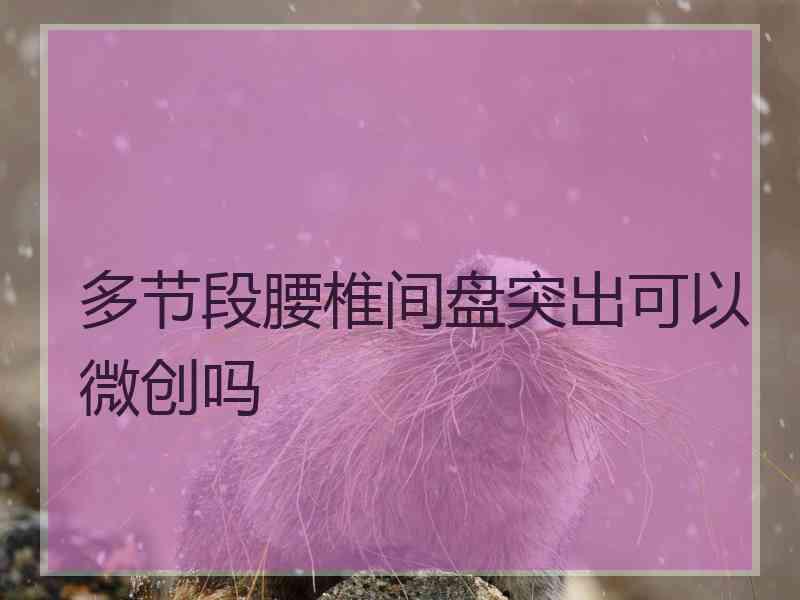 多节段腰椎间盘突出可以微创吗