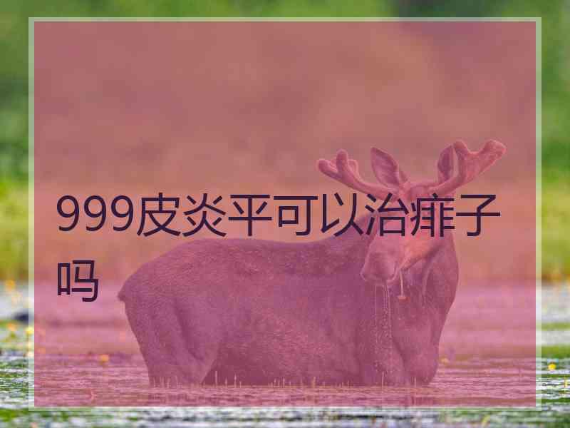 999皮炎平可以治痱子吗